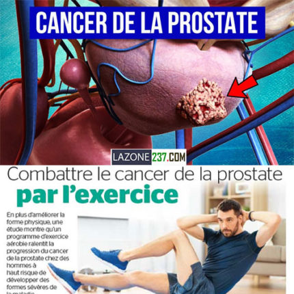 Prostate - Entretien - Soins